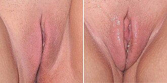 Archiu:Female sexual arousal.JPG